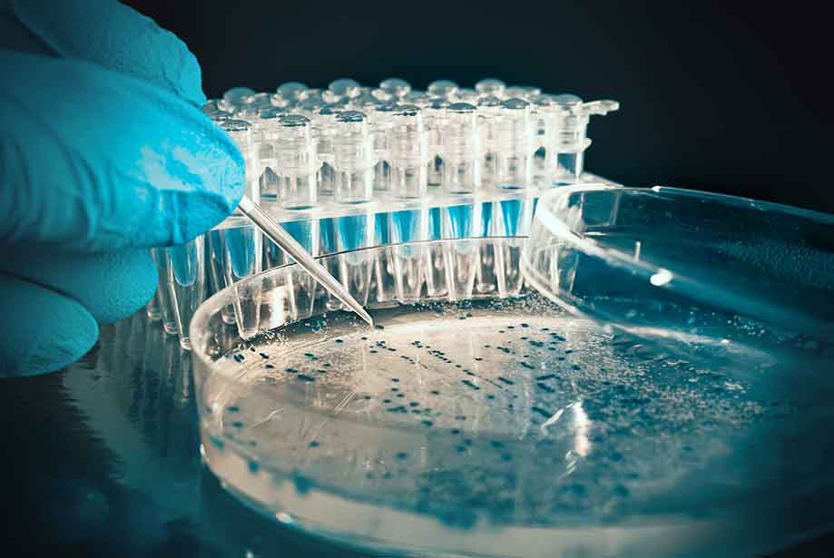 Anti Human Factor XII, Clone 20B2